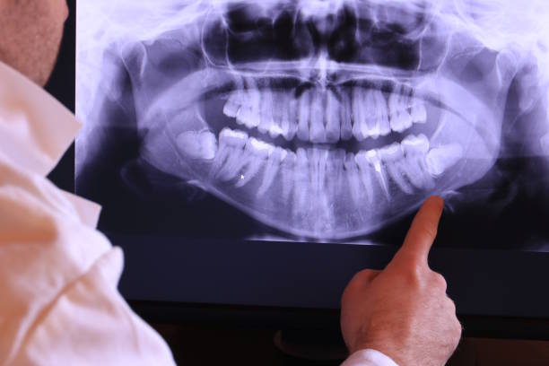 Best Broken or Chipped Tooth Repair in Fairview, NJ