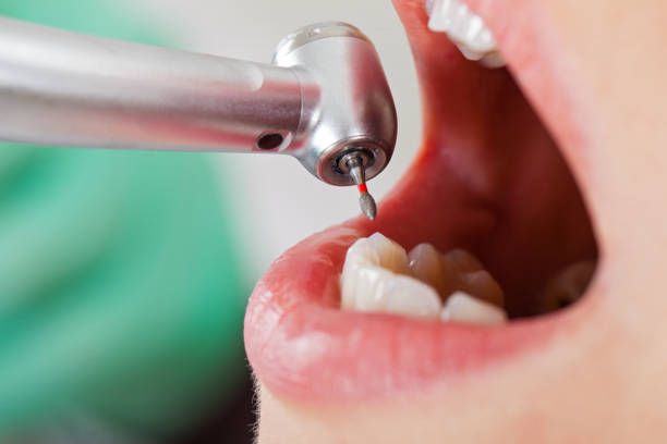 Best Emergency Denture Repair in Fairview, NJ